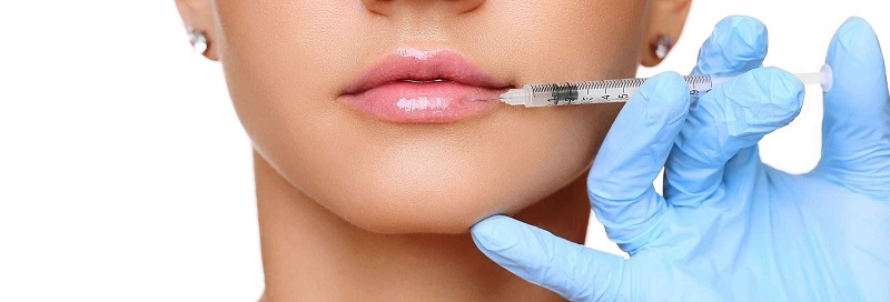 nyc lip filler injection