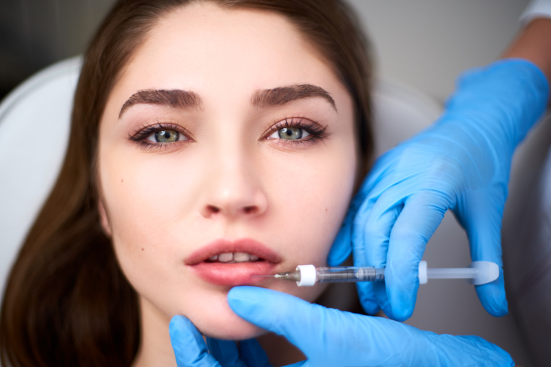 What Not to Do After a Lip Filler Injection